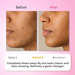 Hair Removal Trilogy Kit